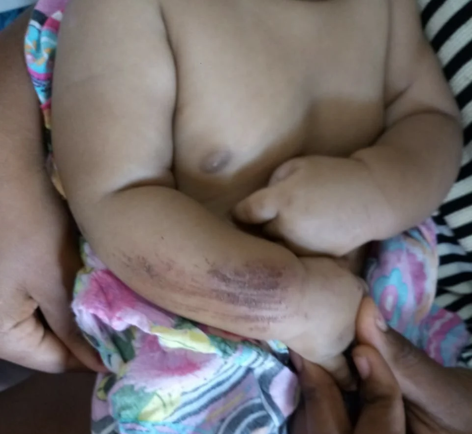 Bebê de 2 meses é agredido pelo próprio pai